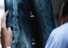 Chiropractor X-Ray Image